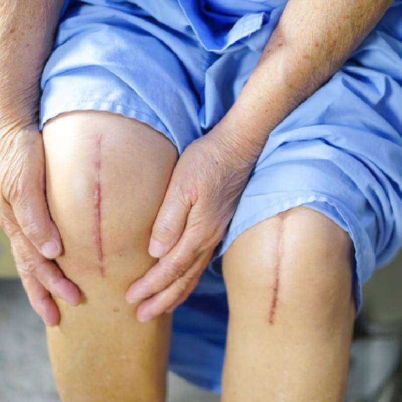 Knee Arthroplasty Therapy Glendale AZ